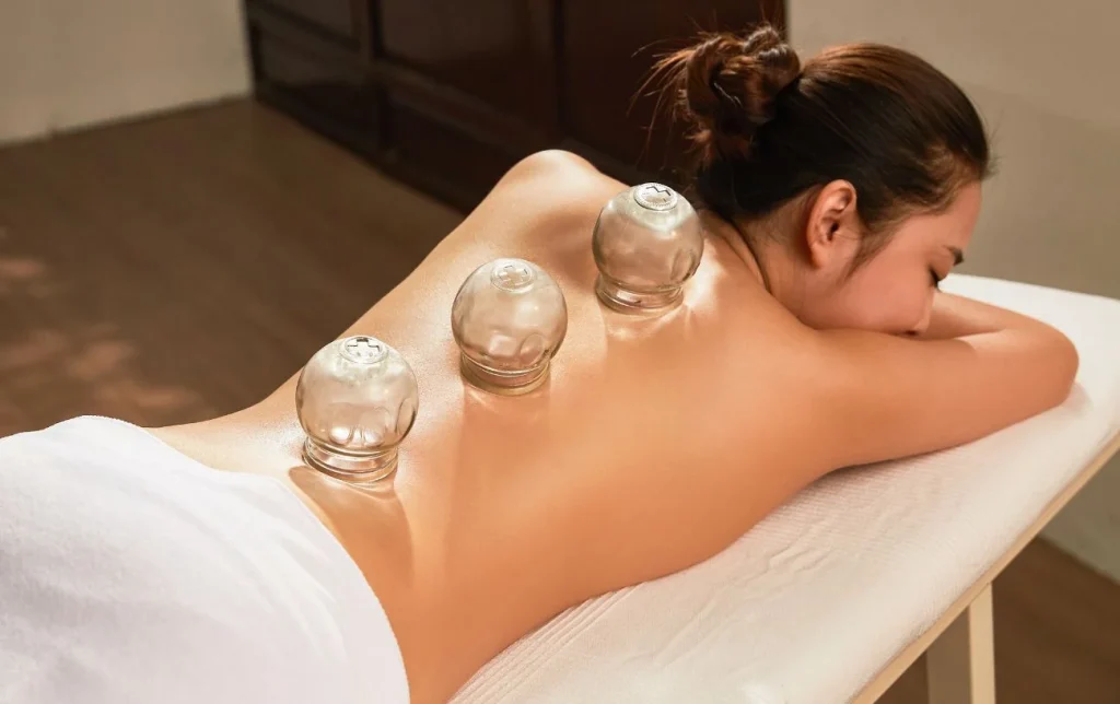cupping masáž košice