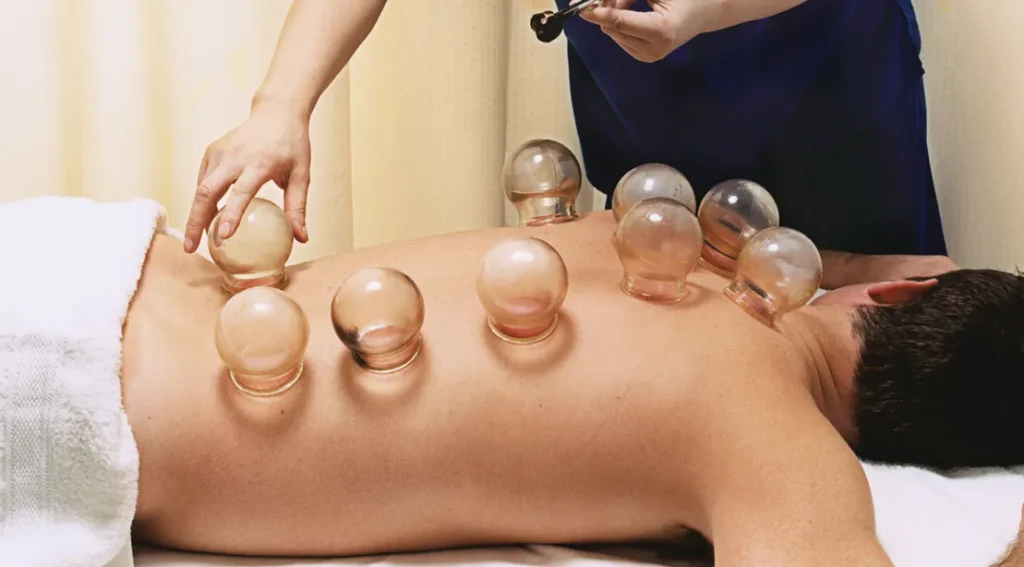 priebeh cupping masáže košice